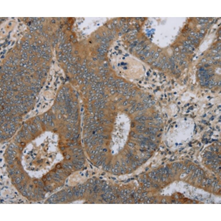 Immunohistochemistry - HSD17B14 Antibody from Signalway Antibody (36532) - Antibodies.com