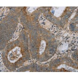 Immunohistochemistry - HSD17B14 Antibody from Signalway Antibody (36532) - Antibodies.com