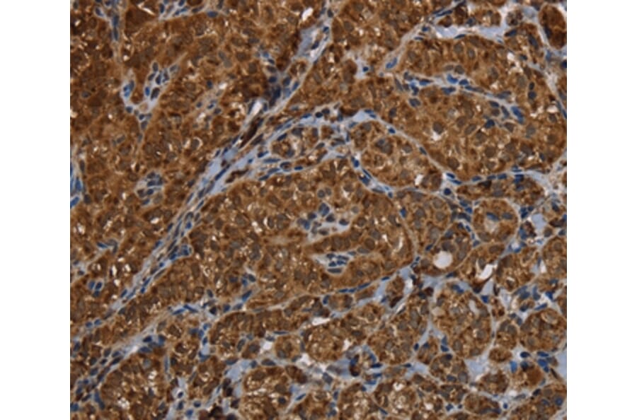 Immunohistochemistry - HSD17B13 Antibody from Signalway Antibody (36534) - Antibodies.com