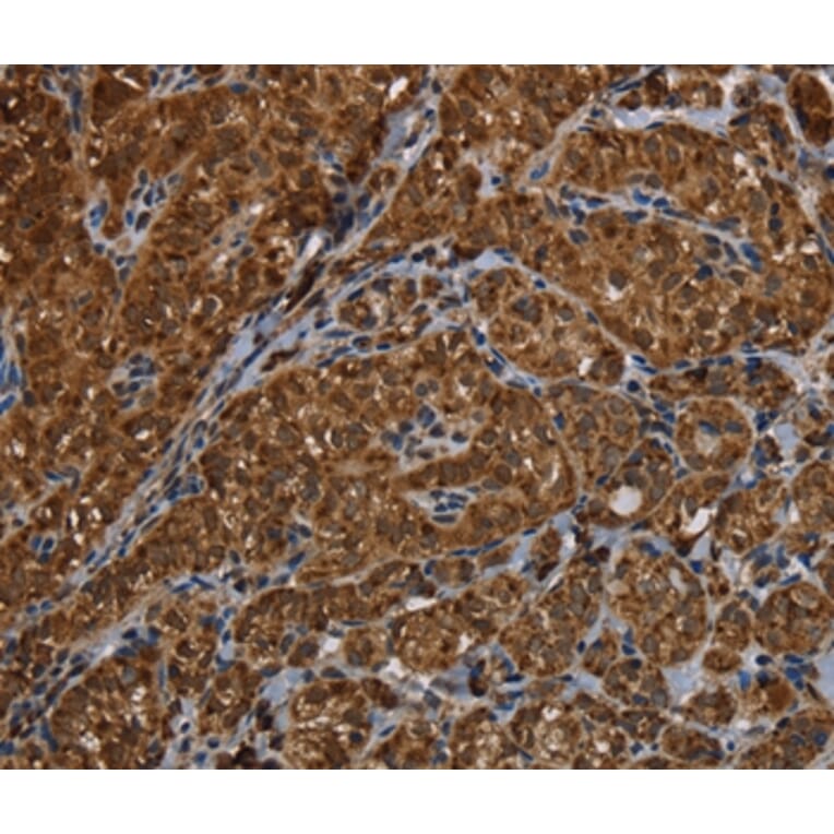Immunohistochemistry - HSD17B13 Antibody from Signalway Antibody (36534) - Antibodies.com