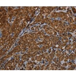 Immunohistochemistry - HSD17B13 Antibody from Signalway Antibody (36534) - Antibodies.com