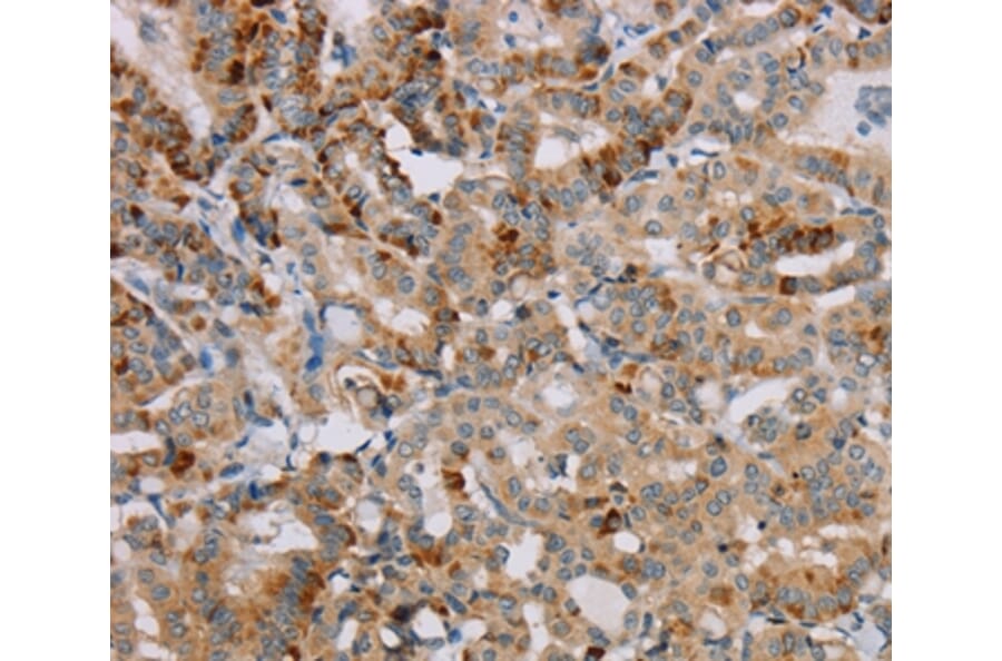 Immunohistochemistry - PPP1R12A Antibody from Signalway Antibody (36628) - Antibodies.com