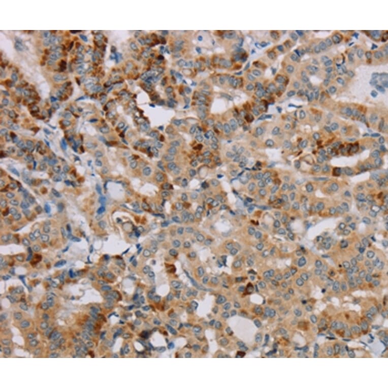 Immunohistochemistry - PPP1R12A Antibody from Signalway Antibody (36628) - Antibodies.com