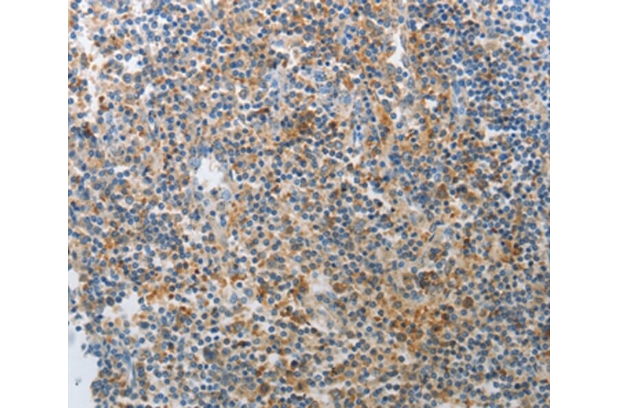 Immunohistochemistry - AD7C-NTP Antibody from Signalway Antibody (36756) - Antibodies.com