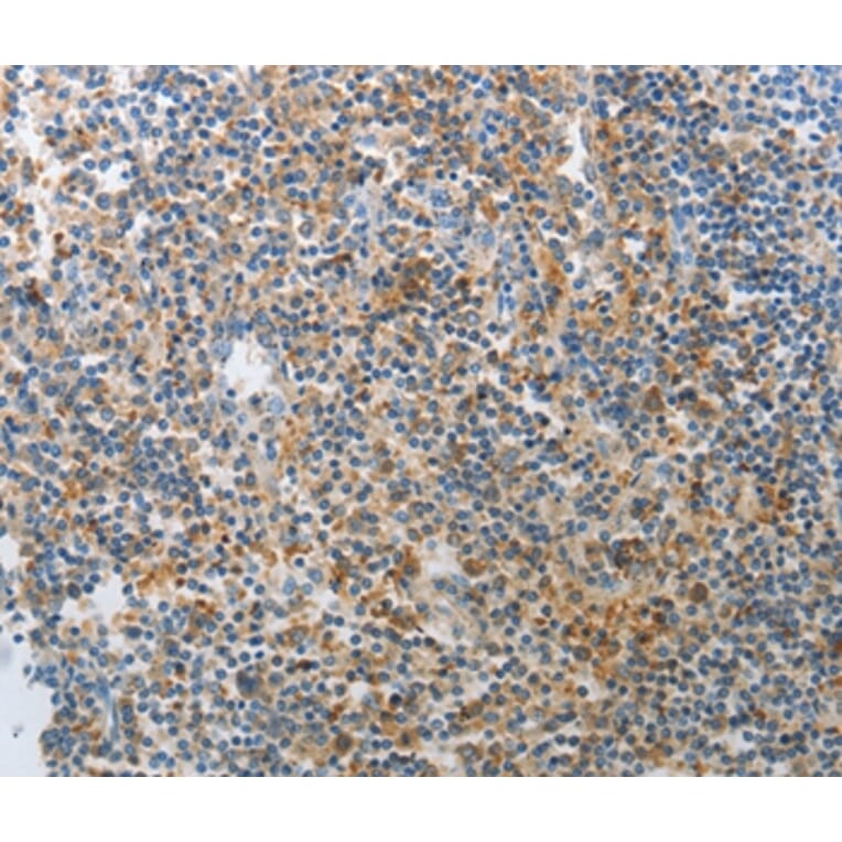 Immunohistochemistry - AD7C-NTP Antibody from Signalway Antibody (36756) - Antibodies.com