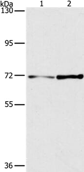 Gel: 6%SDS-PAGE Lysates (from left to right): Lncap and hela cell Amount of lysate: 40ug per lane Primary antibody: 1/350 dilution Secondary antibody dilution: 1/8000 Exposure time: 5 minutes