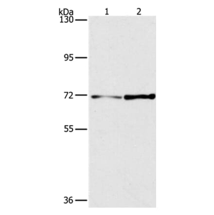 PPP1R13L Antibody from Signalway Antibody (36928) - Antibodies.com