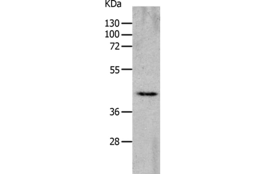 CHRFAM7A Antibody from Signalway Antibody (36993) - Antibodies.com