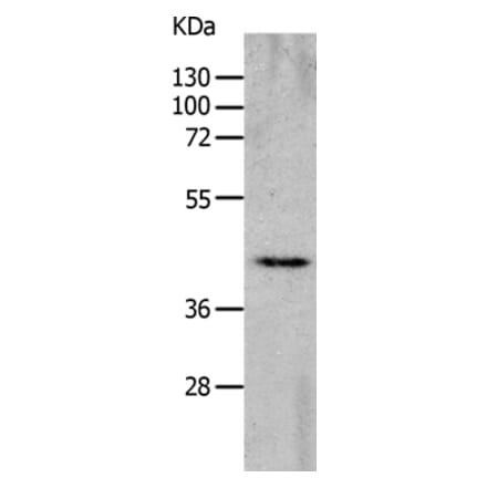 CHRFAM7A Antibody from Signalway Antibody (36993) - Antibodies.com