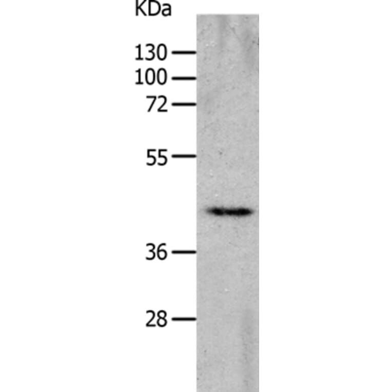 CHRFAM7A Antibody from Signalway Antibody (36993) - Antibodies.com