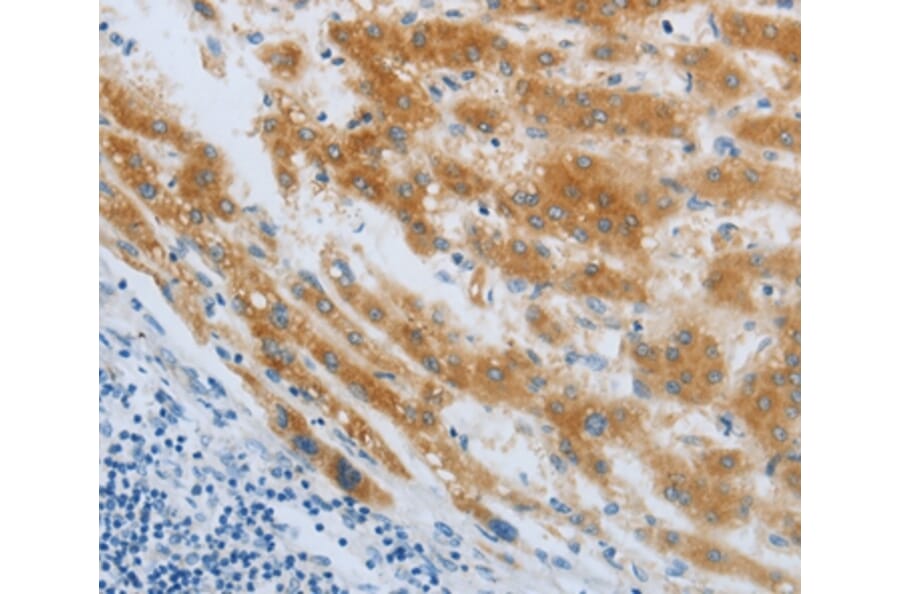 Immunohistochemistry - CHRFAM7A Antibody from Signalway Antibody (36993) - Antibodies.com