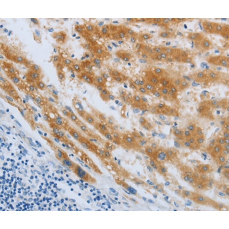 Immunohistochemistry - CHRFAM7A Antibody from Signalway Antibody (36993) - Antibodies.com