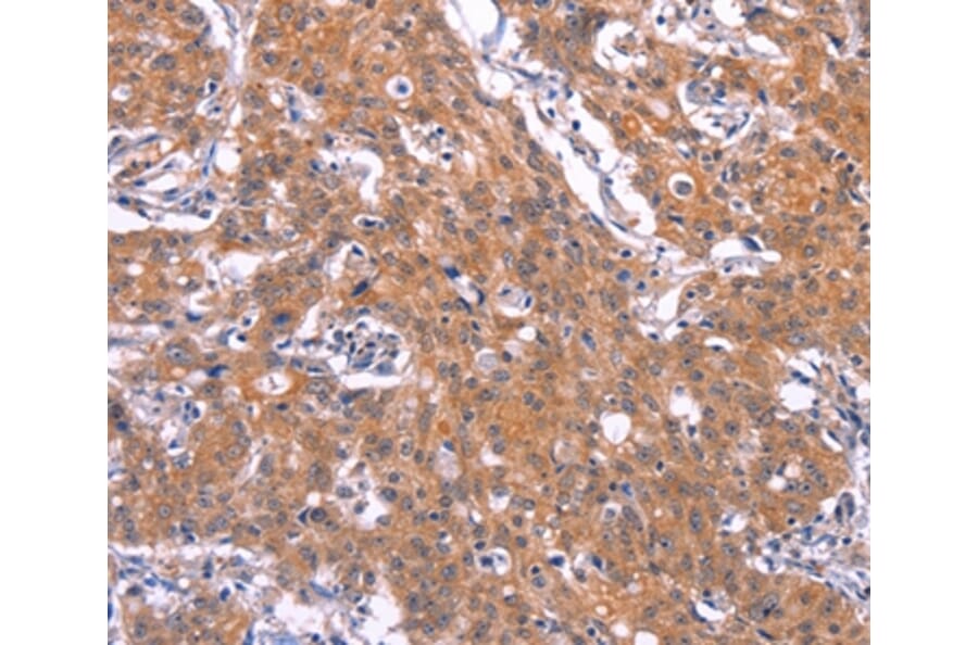 Immunohistochemistry - TNFRSF17 Antibody from Signalway Antibody (37151) - Antibodies.com