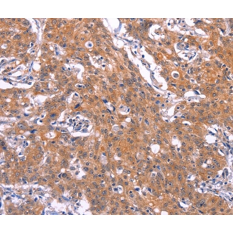 Immunohistochemistry - TNFRSF17 Antibody from Signalway Antibody (37151) - Antibodies.com