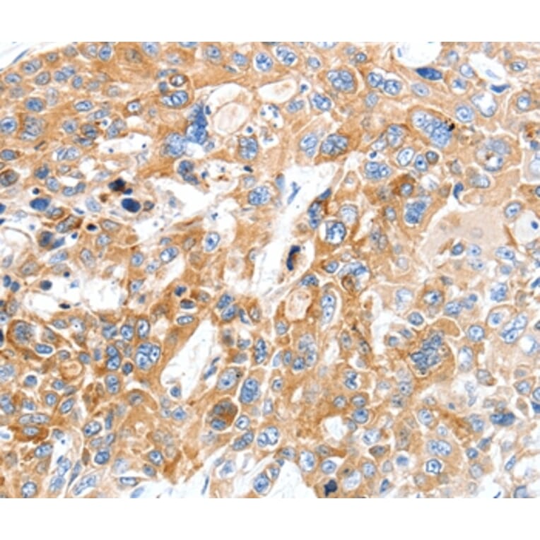 Immunohistochemistry - SLC22A17 Antibody from Signalway Antibody (37244) - Antibodies.com