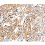 Immunohistochemistry - SLC22A17 Antibody from Signalway Antibody (37244) - Antibodies.com