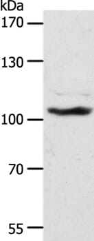 Gel: 8% SDS-PAGE Lysate: 40ug NIH/3T3 cell Primary antibody: 1/1300 dilution Secondary antibody dilution: 1/8000 Exposure time: 1 hour
