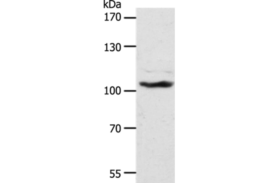 ADAMTS17 Antibody from Signalway Antibody (37315) - Antibodies.com