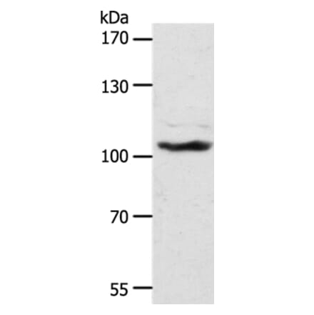 ADAMTS17 Antibody from Signalway Antibody (37315) - Antibodies.com