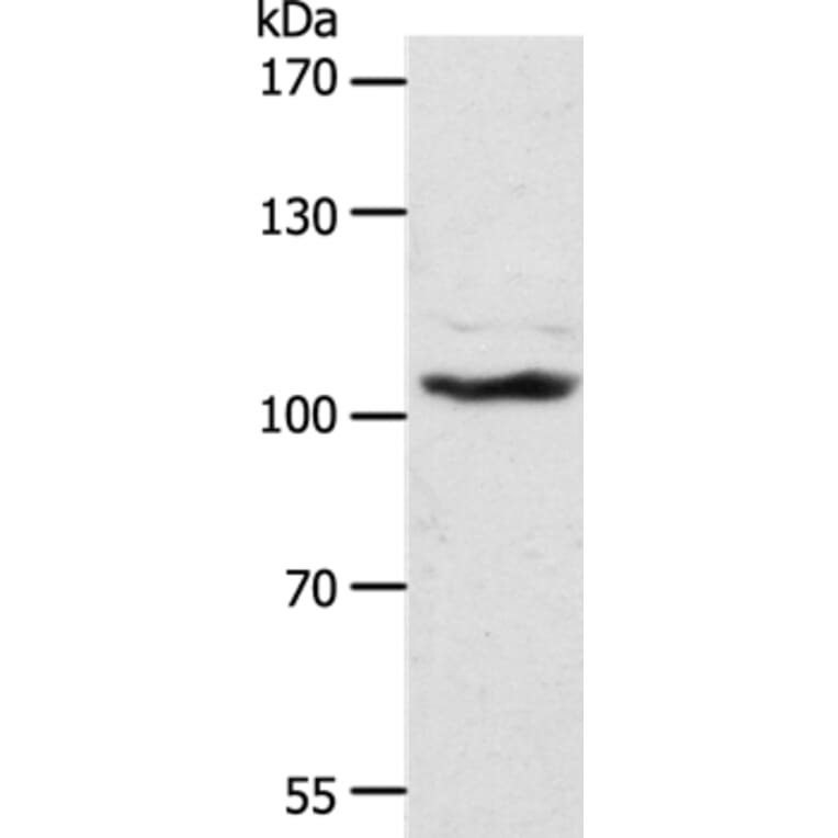 ADAMTS17 Antibody from Signalway Antibody (37315) - Antibodies.com