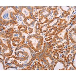 Immunohistochemistry - ADAMTS17 Antibody from Signalway Antibody (37315) - Antibodies.com