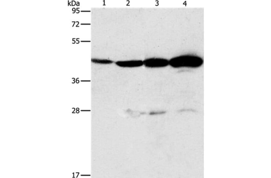 APOBEC3D Antibody from Signalway Antibody (37339) - Antibodies.com