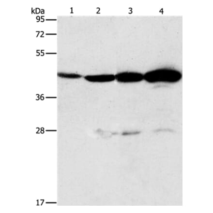 APOBEC3D Antibody from Signalway Antibody (37339) - Antibodies.com