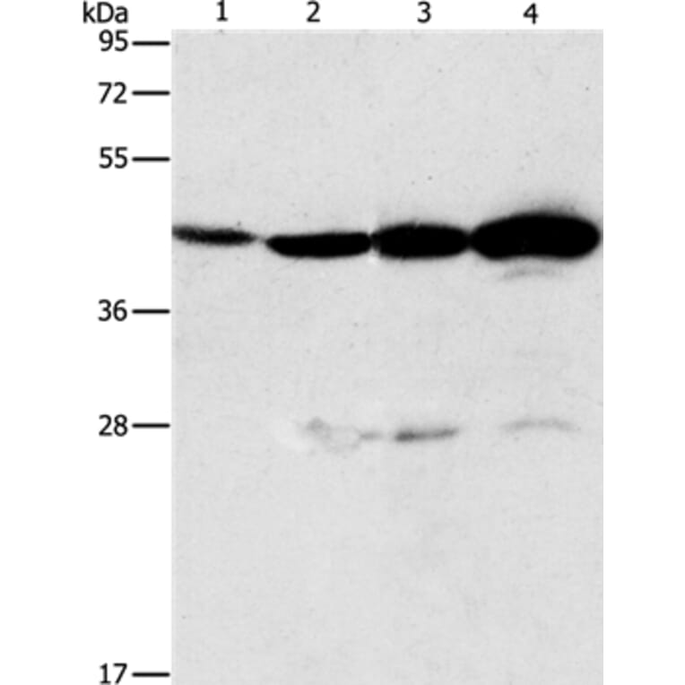 APOBEC3D Antibody from Signalway Antibody (37339) - Antibodies.com