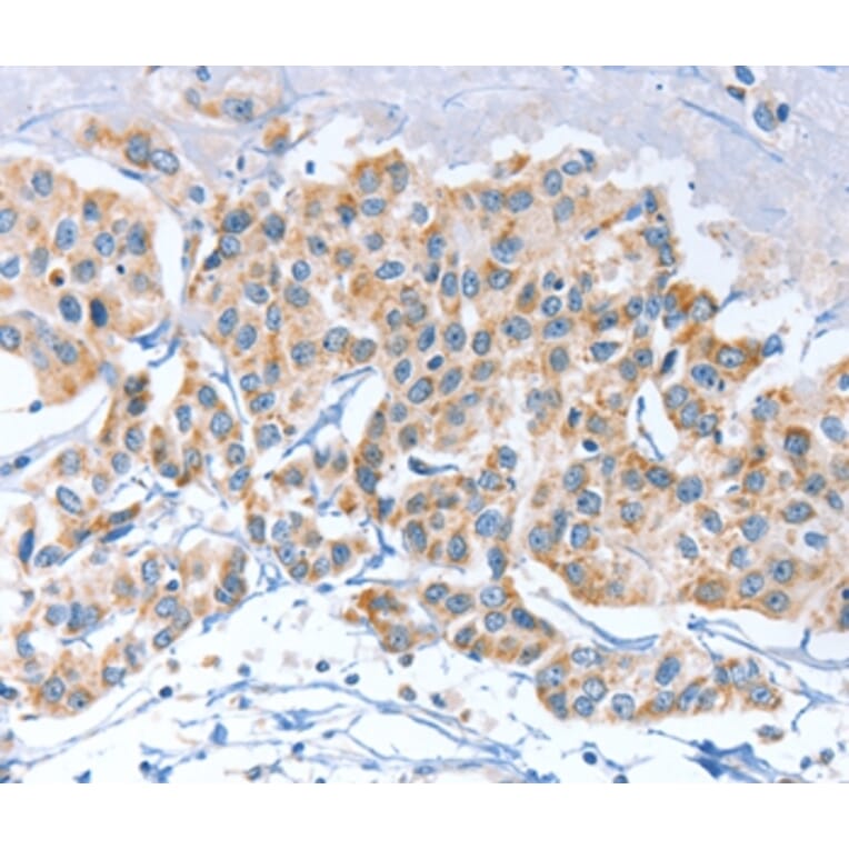 Immunohistochemistry - APOBEC3D Antibody from Signalway Antibody (37339) - Antibodies.com