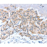 Immunohistochemistry - APOBEC3D Antibody from Signalway Antibody (37339) - Antibodies.com
