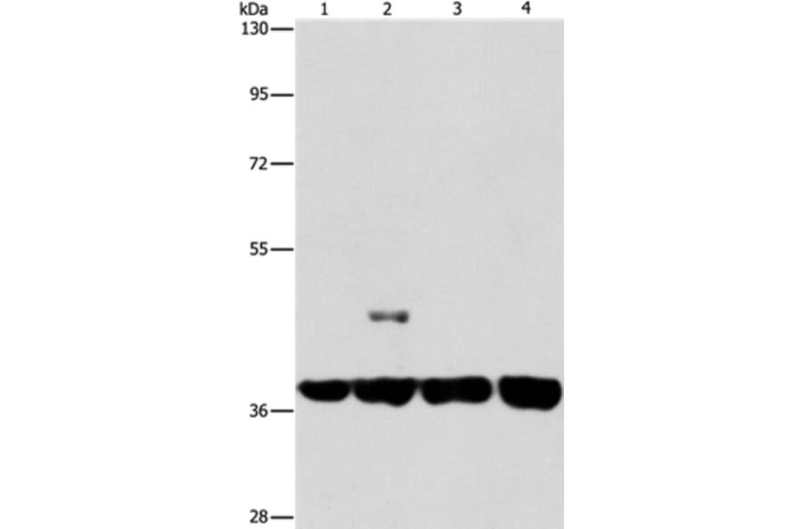 SERPINA9 Antibody from Signalway Antibody (37387) - Antibodies.com