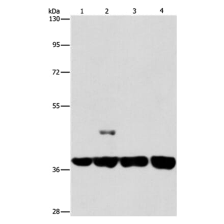 SERPINA9 Antibody from Signalway Antibody (37387) - Antibodies.com