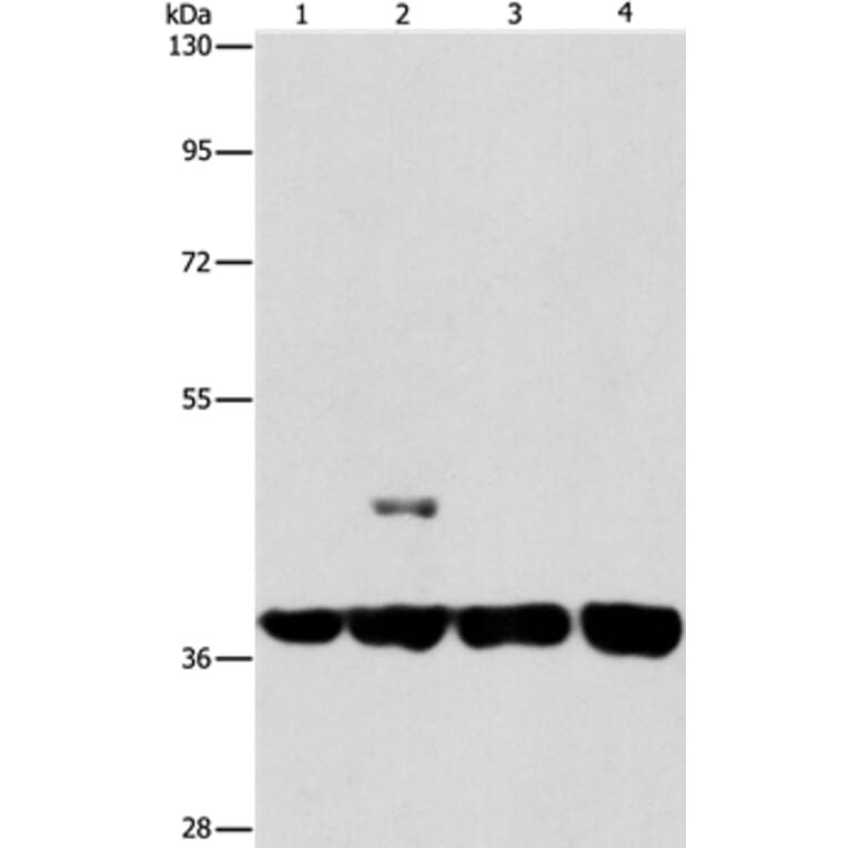 SERPINA9 Antibody from Signalway Antibody (37387) - Antibodies.com