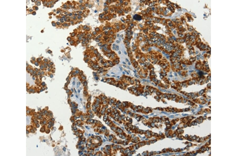 Immunohistochemistry - SERPINA9 Antibody from Signalway Antibody (37387) - Antibodies.com