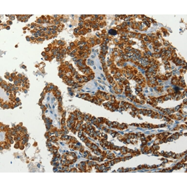 Immunohistochemistry - SERPINA9 Antibody from Signalway Antibody (37387) - Antibodies.com