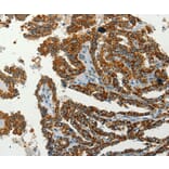 Immunohistochemistry - SERPINA9 Antibody from Signalway Antibody (37387) - Antibodies.com