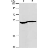 MAPKAPK2 Antibody from Signalway Antibody (37715) - Antibodies.com