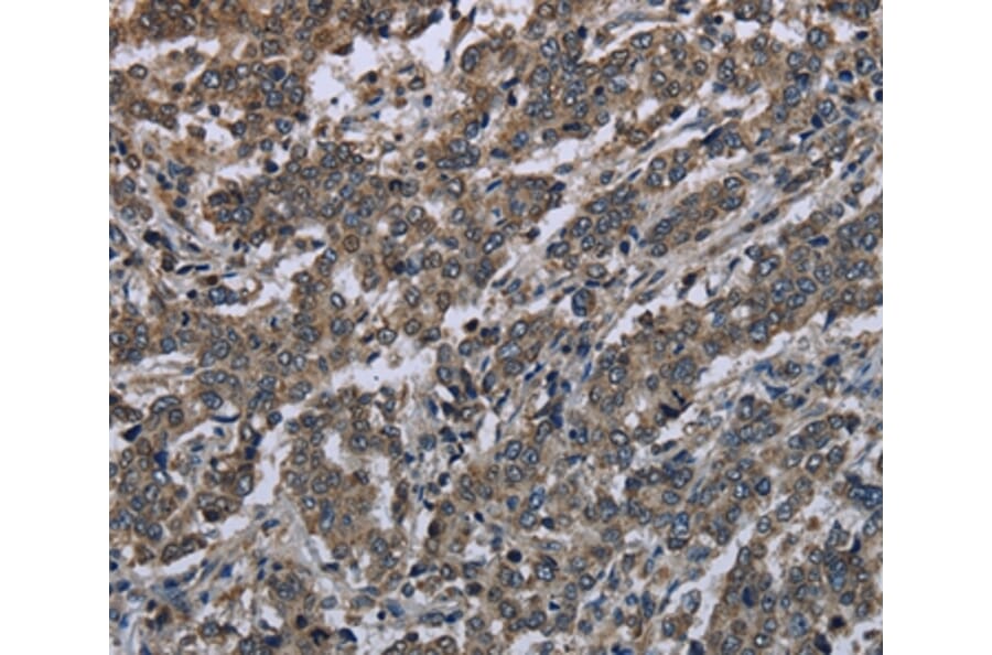 Immunohistochemistry - MAPKAPK2 Antibody from Signalway Antibody (37715) - Antibodies.com
