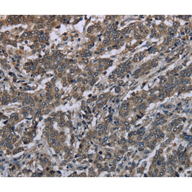 Immunohistochemistry - MAPKAPK2 Antibody from Signalway Antibody (37715) - Antibodies.com