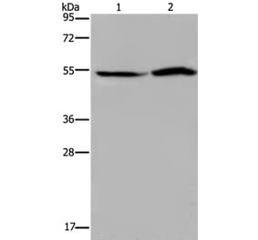 SLC22A12 Antibody from Signalway Antibody (37780) - Antibodies.com