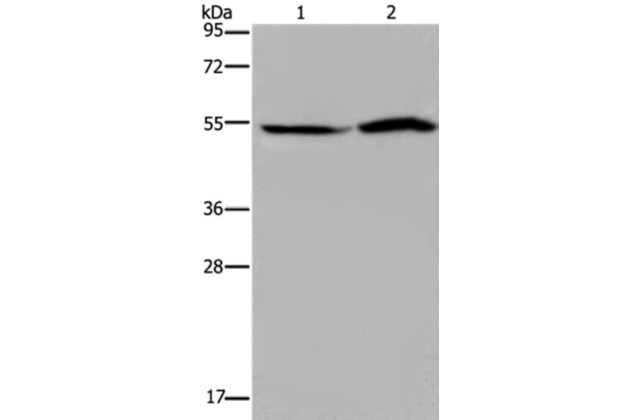 SLC22A12 Antibody from Signalway Antibody (37780) - Antibodies.com
