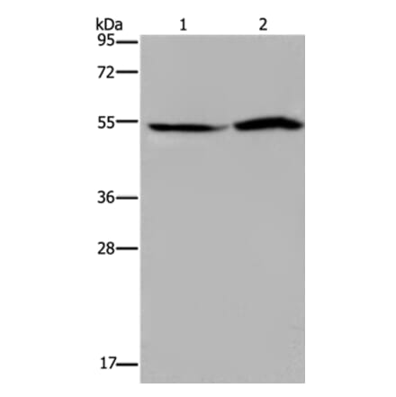 SLC22A12 Antibody from Signalway Antibody (37780) - Antibodies.com