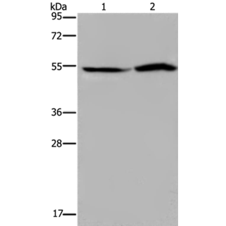 SLC22A12 Antibody from Signalway Antibody (37780) - Antibodies.com