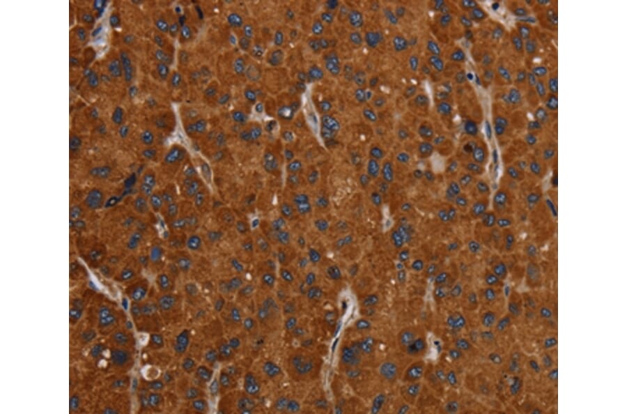 Immunohistochemistry - SLC22A12 Antibody from Signalway Antibody (37780) - Antibodies.com