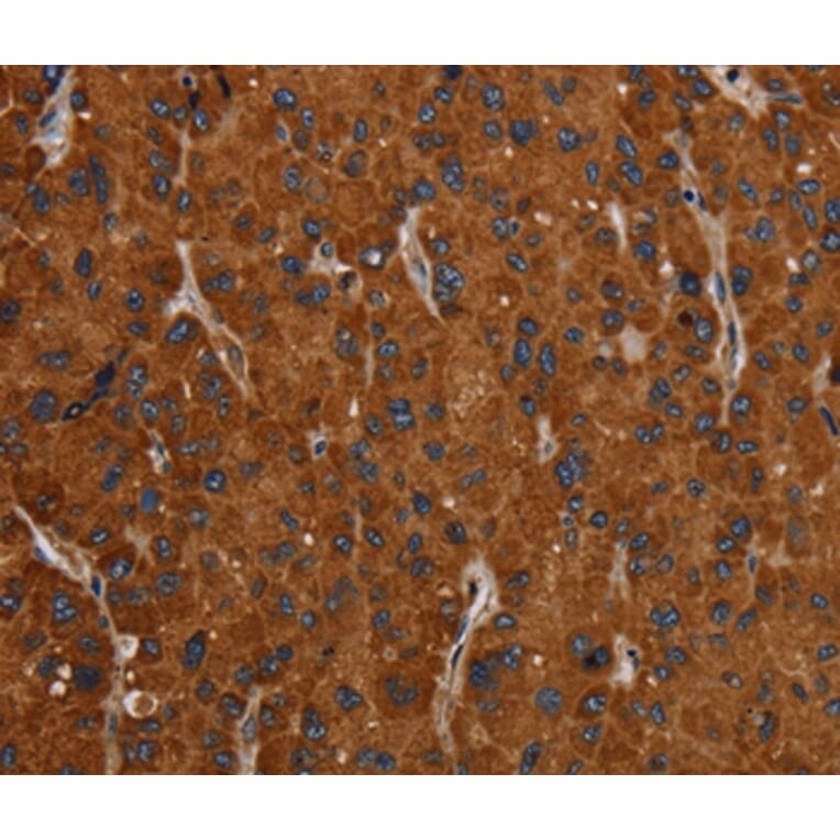 Immunohistochemistry - SLC22A12 Antibody from Signalway Antibody (37780) - Antibodies.com