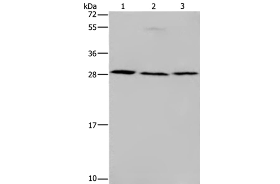 TP53INP1 Antibody from Signalway Antibody (37790) - Antibodies.com