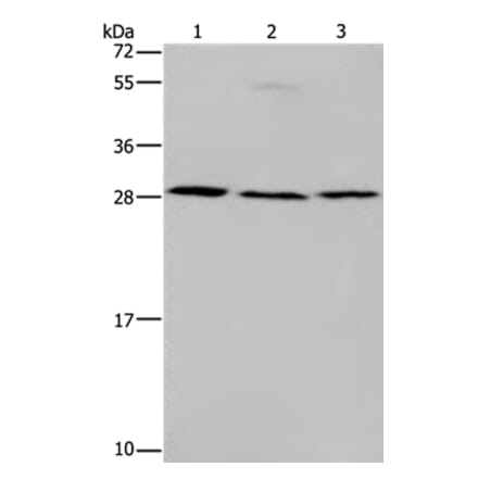 TP53INP1 Antibody from Signalway Antibody (37790) - Antibodies.com