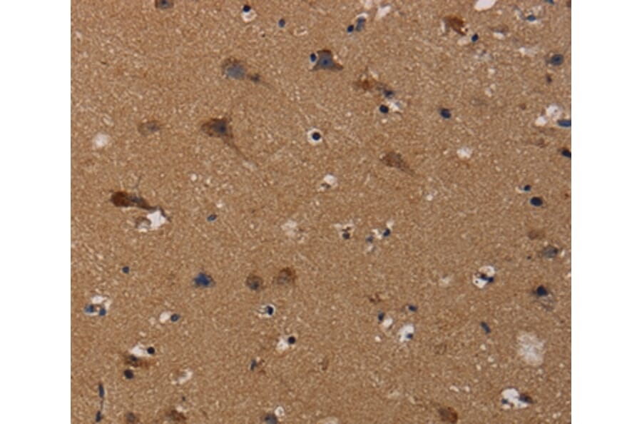 Immunohistochemistry - TP53INP1 Antibody from Signalway Antibody (37790) - Antibodies.com