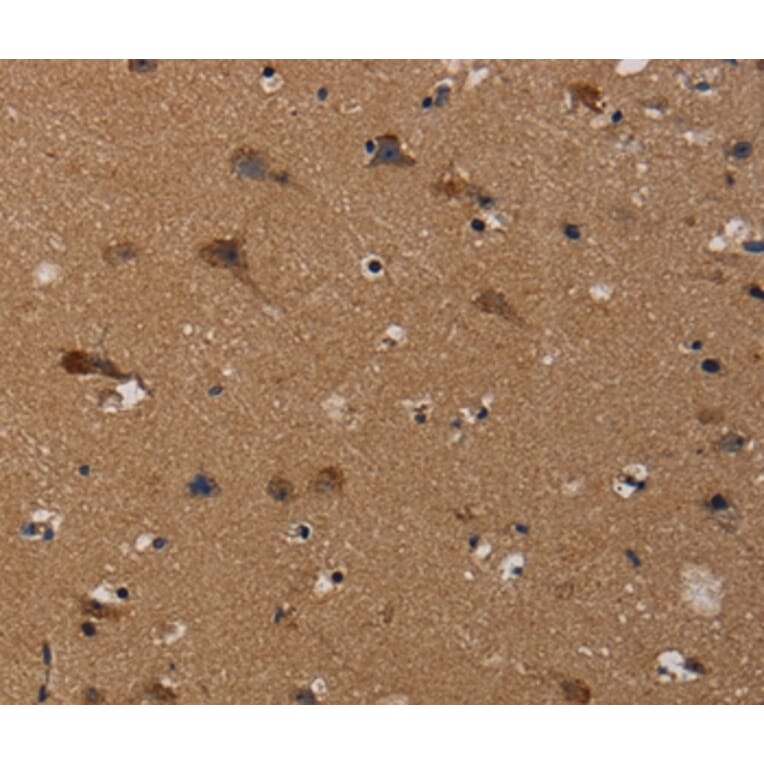 Immunohistochemistry - TP53INP1 Antibody from Signalway Antibody (37790) - Antibodies.com
