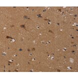Immunohistochemistry - TP53INP1 Antibody from Signalway Antibody (37790) - Antibodies.com